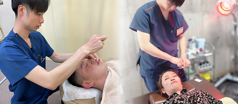 顔用の細い鍼を使用